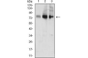 Western blot analysis using ACSS1 mouse mAb against MOLT4 (1), Jurkat (2), and HL-60 (3) cell lysate. (ACSS1 antibody  (AA 548-689))