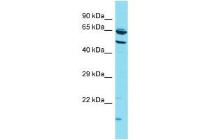 Host: Rabbit Target Name: CCZ1B Sample Type: HT1080 Whole Cell lysates Antibody Dilution: 1. (CCZ1B antibody  (N-Term))