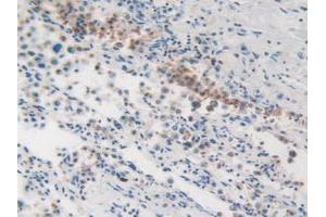 IHC-P analysis of Human Lung Tissue, with DAB staining. (MVP antibody  (AA 2-272))