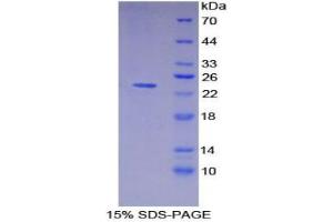 SDS-PAGE analysis of Pig MHCDRa Protein. (HLA-DRA Protein)