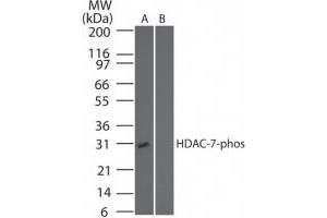 Image no. 1 for anti-Histone Deacetylase 7 (HDAC7) (pSer318) antibody (ABIN225622) (HDAC7 antibody  (pSer318))