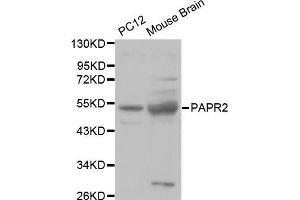 Western blot analysis of extracts of various cell lines, using PARK2 antibody (ABIN5970356) at 1/1000 dilution. (Parkin antibody)