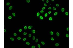 Immunofluorescence staining of Hela cells (treated with 30mM sodium butyrate for 4h) with ABIN7139171 at 1:2. (HIST1H4A antibody  (acLys20))