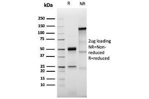 SDS-PAGE Analysis Purified Prolactin Receptor Recombinant Rabbit Monoclonal (PRLR3785R). (Recombinant Prolactin Receptor antibody)