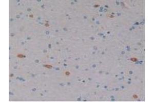 DAB staining on IHC-P; Samples: Human Brain Tissue. (EPO antibody  (AA 28-193))