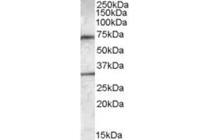 Western Blotting (WB) image for anti-Lipase, Endothelial (LIPG) (AA 50-63) antibody (ABIN343126) (LIPG antibody  (AA 50-63))