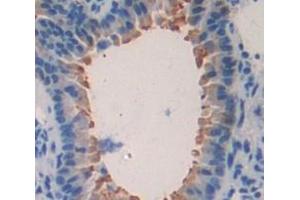 Used in DAB staining on fromalin fixed paraffin- embedded Kidney tissue (HPS1 antibody  (AA 1-275))