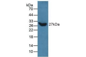 Detection of Recombinant TLN, Human using Polyclonal Antibody to Talin 1 (TLN1) (TLN1 antibody  (AA 975-1181))