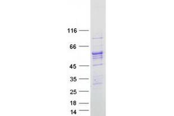 ALDH1B1 Protein (Myc-DYKDDDDK Tag)