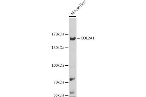 COL2A1 antibody  (AA 873-1072)