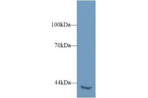 Detection of PLCh2 in Mouse Kidney lysate using Polyclonal Antibody to Phospholipase C Eta 2 (PLCh2) (PLCH2 antibody  (AA 1-257))