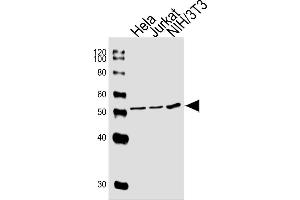 Sample Tissue/Cells lysates probed with PPARA (1331CT894. (PPARA antibody)