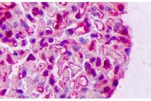 Anti-LGALS1 / Galectin 1 antibody IHC staining of human kidney, glomeruli. (LGALS1/Galectin 1 antibody)
