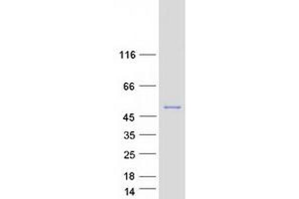 Apoptosis Inhibitor 5 Protein (API5) (Transcript Variant 3) (Myc-DYKDDDDK Tag)