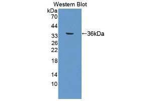 Figure. (TBXA2R antibody  (AA 3-324))