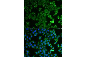 Immunofluorescence analysis of HeLa cells using NPRL2 antibody. (NPRL2 antibody)