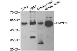 Western blot analysis of extracts of various cell lines, using SMYD2 antibody. (SMYD2A antibody)