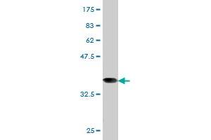 Western Blot detection against Immunogen (37. (RRM1 antibody  (AA 644-753))