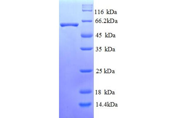 LINGO1 Protein (AA 37-555) (His tag)