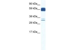 Western Blotting (WB) image for anti-Z Ion Channel 5 antibody (ABIN2460780) (Z Ion Channel 5 antibody)