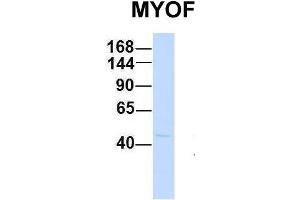 Host:  Rabbit  Target Name:  MYOF  Sample Type:  Human Fetal Brain  Antibody Dilution:  1. (Myoferlin antibody  (C-Term))