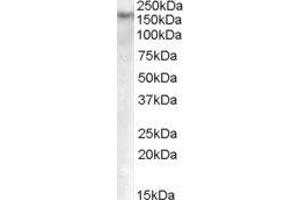 ABIN2562262 (0. (DNMT1 antibody  (Internal Region))