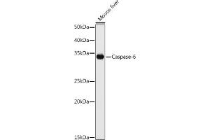Western blot analysis of extracts of various cell lines, using Caspase-6 antibody (ABIN3022544, ABIN3022545, ABIN3022546 and ABIN6218892) at 1:1000 dilution. (Caspase 6 antibody  (AA 24-293))