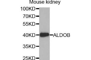 Western Blotting (WB) image for anti-Aldolase B, Fructose-Bisphosphate (ALDOB) (AA 1-200) antibody (ABIN6220333) (ALDOB antibody  (AA 1-200))