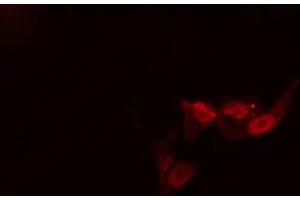 ABIN6269039 staining MCF-7 cells by IF/ICC. (Activin A Receptor Type IB/ALK-4 antibody  (Internal Region))