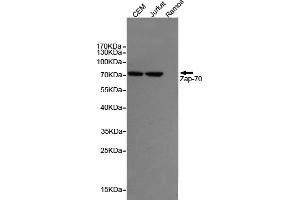 Western blot detection of Z70 in CEM and Jurkat cell lysates,negative in the Ramos cell lysates using Z70 mouse mAb (1:1000 diluted). (ZAP70 antibody)