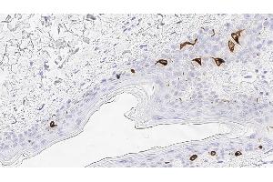 Immunohistochemistry (IHC) image for anti-CD207 Molecule, Langerin (CD207) antibody (ABIN7538905) (CD207 antibody)