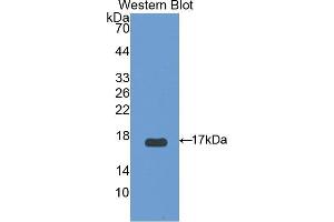 Western blot analysis of the recombinant protein. (UCP2 antibody  (AA 154-289))