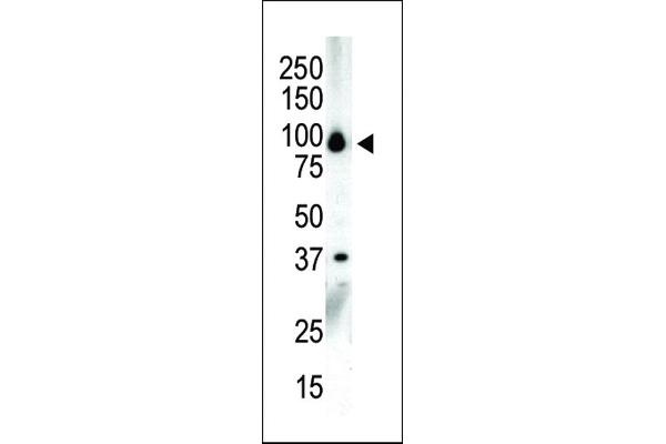 PRKD3 antibody  (C-Term)