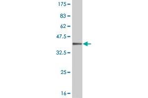 Western Blot detection against Immunogen (35. (MEOX1 antibody  (AA 165-252))