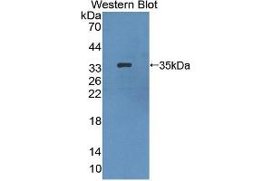 Figure. (HPS1 antibody  (AA 1-275))