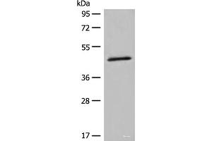 Western blot analysis of K562 cell lysate using HMBS Polyclonal Antibody at dilution of 1:450 (HMBS antibody)