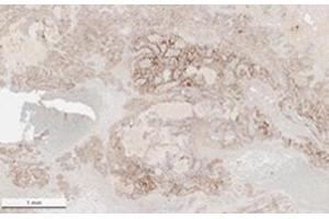 Immunohistochemistry (IHC) image for anti-SARS-Coronavirus Nucleocapsid Protein (SARS-CoV N) antibody (ABIN6952544)