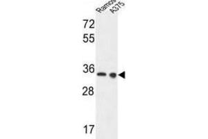 Western Blotting (WB) image for anti-Lactate Dehydrogenase A (LDHA) antibody (ABIN3004211) (Lactate Dehydrogenase A antibody)