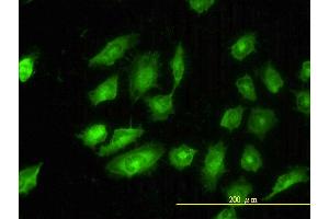 Immunofluorescence of monoclonal antibody to TPM4 on HeLa cell. (Tropomyosin 4 antibody  (AA 1-248))