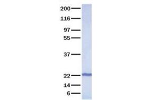 Validation with Western Blot (FGF18 Protein)