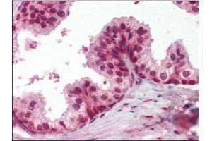 Human Prostate (formalin-fixed, paraffin-embedded) stained with PPP4Cfollowed by biotinylated secondary antibody, alkaline phosphatase-streptavidin and chromogen. (PPP4C antibody  (C-Term))