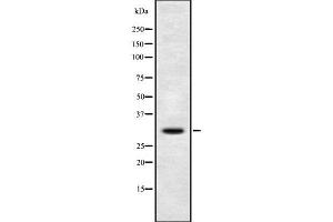 Western blot analysis of DIO3 using COS7 whole cell lysates (DIO3 antibody)