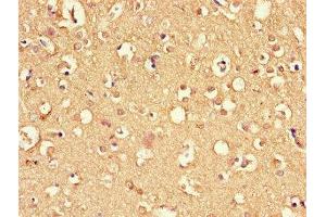 Immunohistochemistry of paraffin-embedded human brain tissue using ABIN7166807 at dilution of 1:100 (DNAJC6 antibody  (AA 201-500))