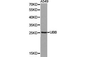 Western Blotting (WB) image for anti-Ubiquitin B (UBB) antibody (ABIN1875248) (Ubiquitin B antibody)