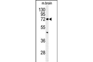 Western blot analysis of ABCD2 Antibody in mouse brain tissue lysates (35ug/lane) (CCL17 antibody  (AA 269-298))