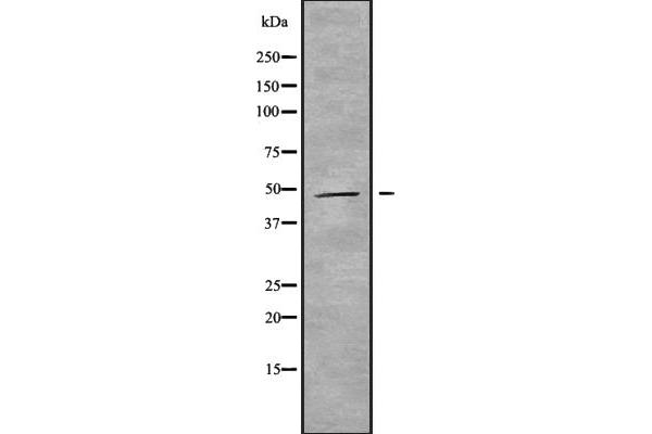 MAGEA11 antibody  (C-Term)