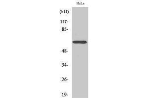 Western Blotting (WB) image for anti-Nuclear Factor-kB p65 (NFkBP65) (Thr696) antibody (ABIN3185884) (NF-kB p65 antibody  (Thr696))