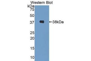 Western Blotting (WB) image for Decorin (DCN) ELISA Kit (ABIN6574301)