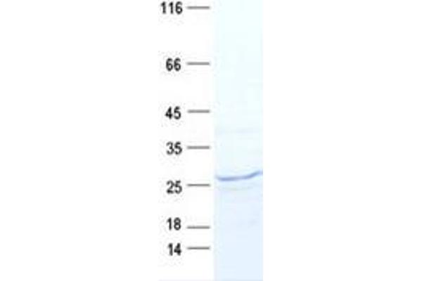 MRPS23 Protein (DYKDDDDK Tag)