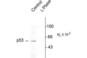 Image no. 1 for anti-Tumor Protein P53 (TP53) (pSer392) antibody (ABIN372695) (p53 antibody  (pSer392))